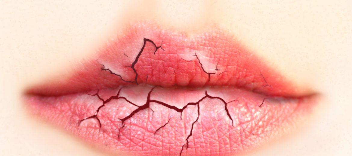 labios cortados