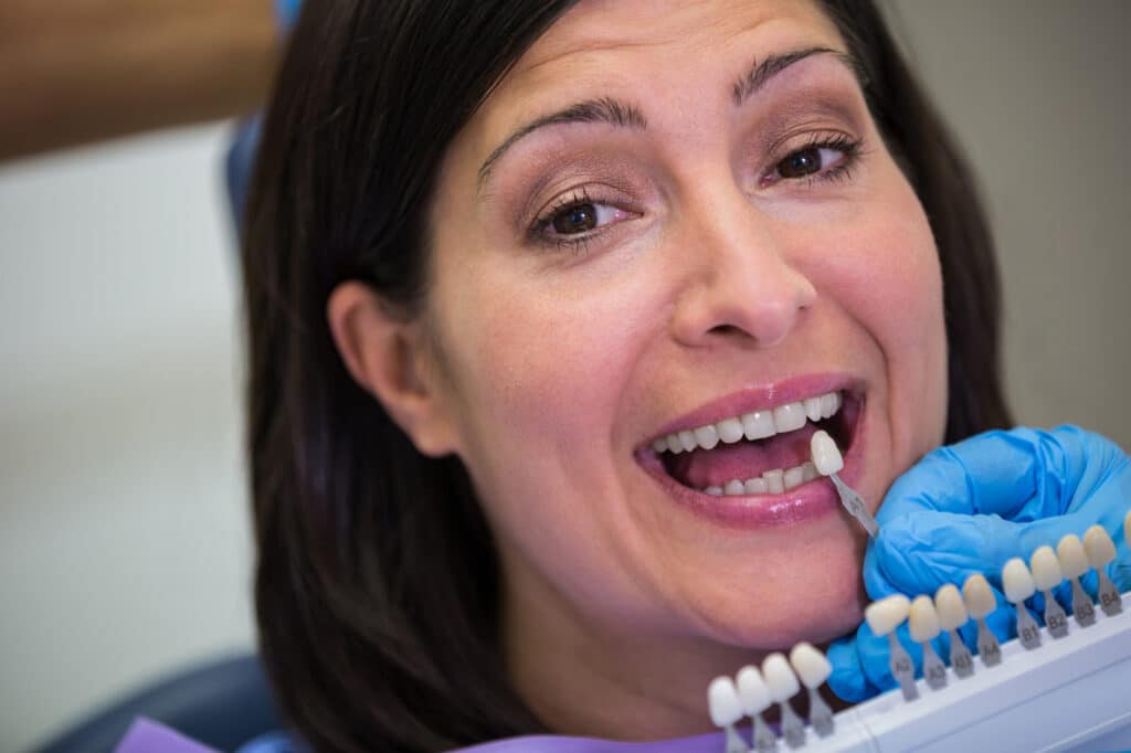Carilla dental