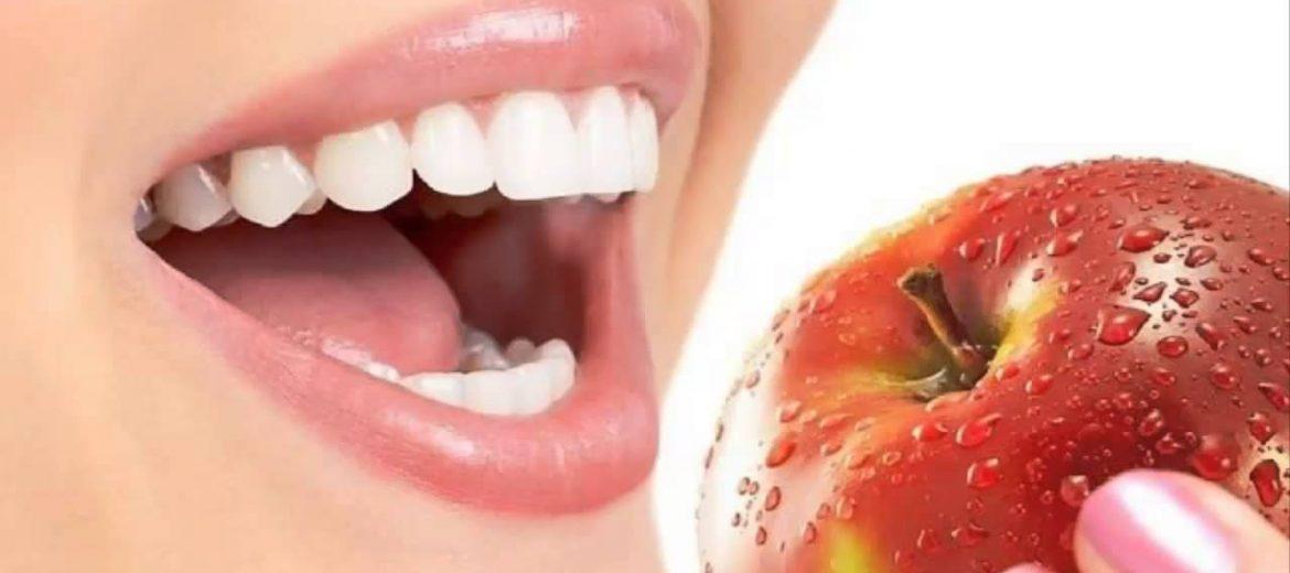 manzana