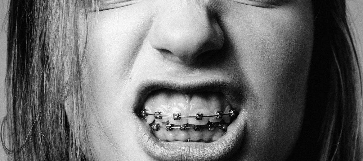 brackets