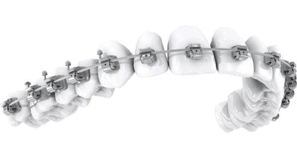 brackets metalicos