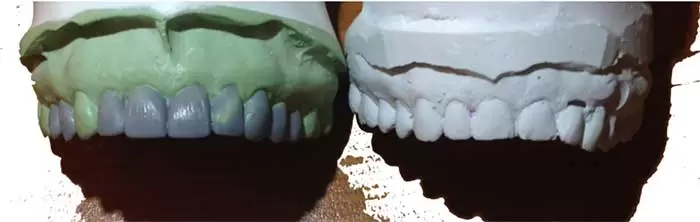Molde del diseño de sonrisa
