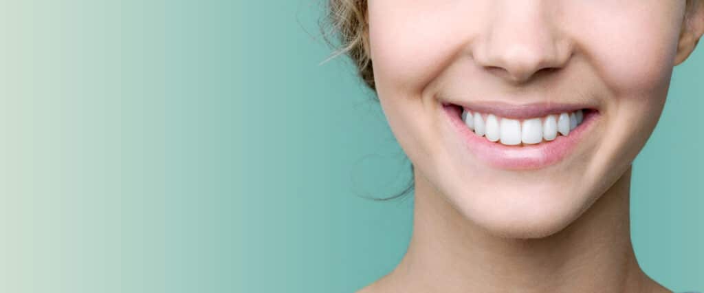 duración del blanqueamiento dental