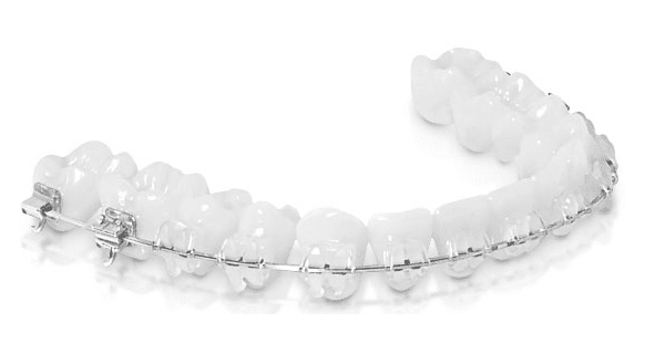 brackets zafiro