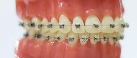 brackets acero