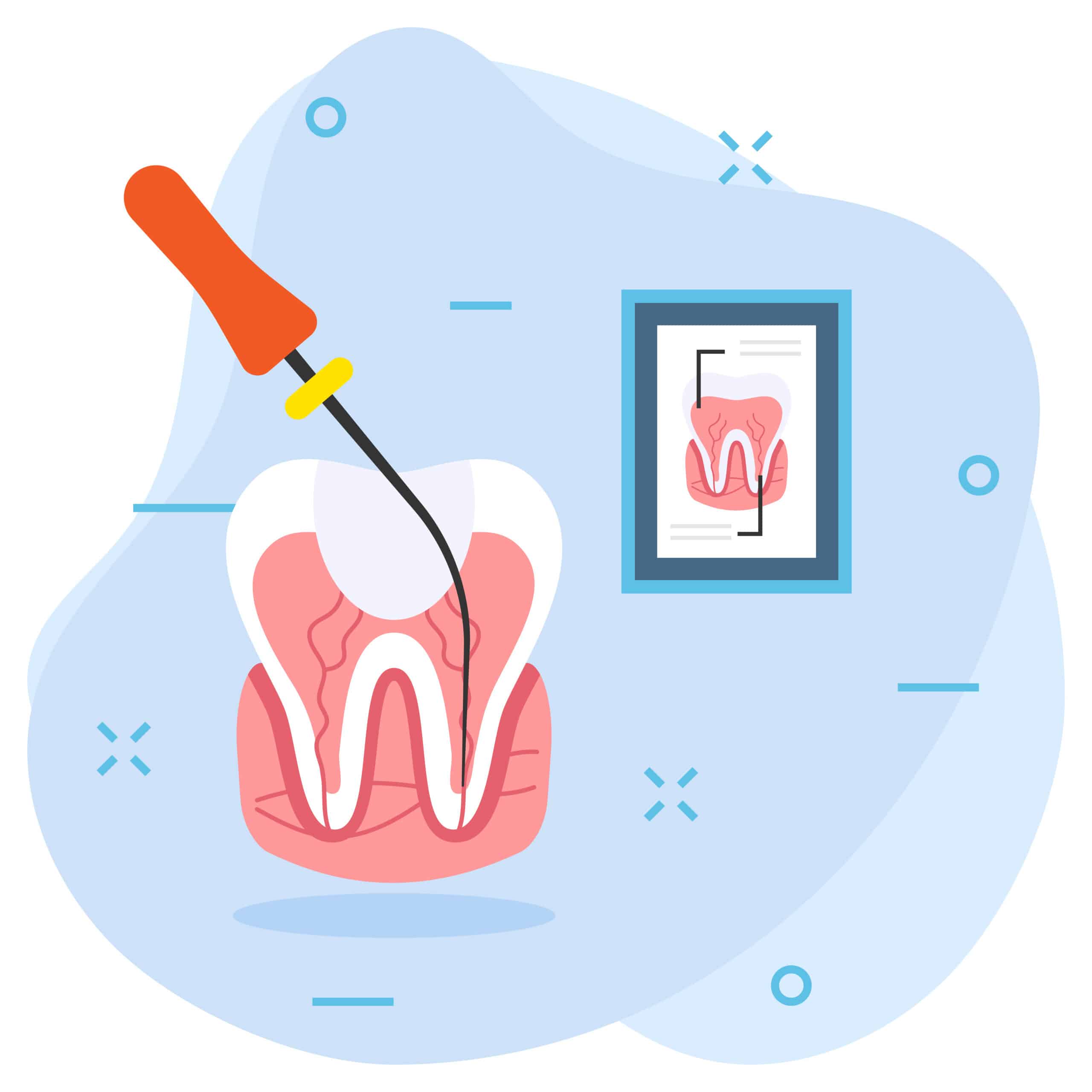 Icono Cirugía Plástica Periodontal