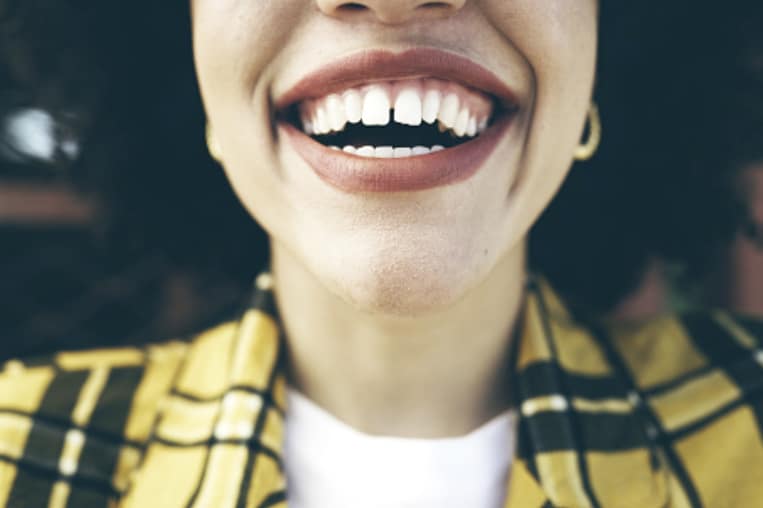 dientes separados