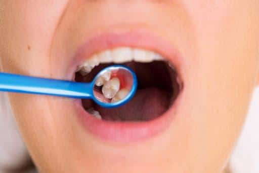 periodoncia