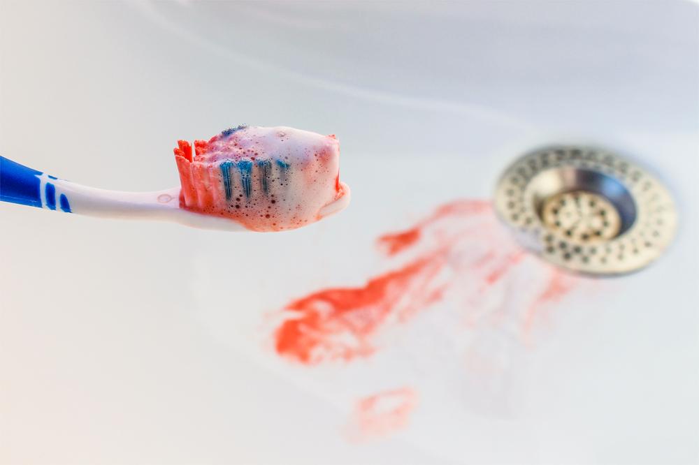 cepillo dientes con sangre