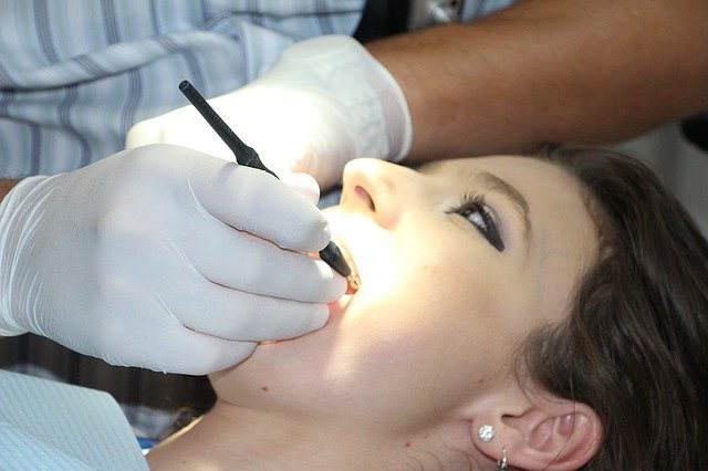 tipos de blanqueamiento dental