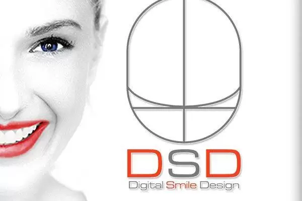 Tecnología Vanguardista - ‘DSD’ Diseño Digital de Sonrisas