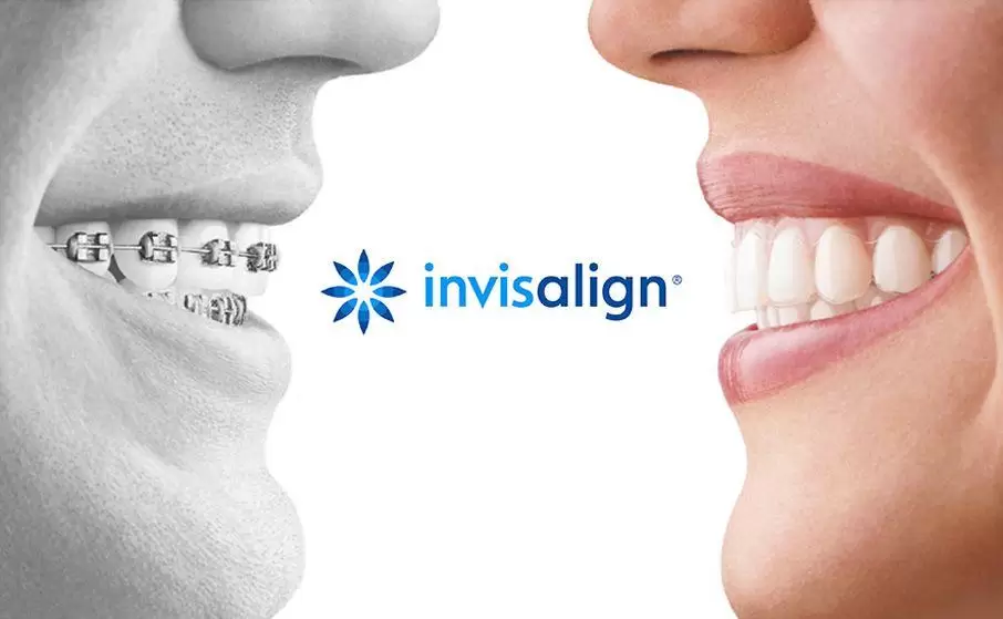 Tecnología Vanguardista - ‘Invisalign’ Ortodoncia Invisible