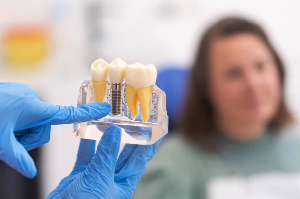 Dentista mostrando cómo cuidar un implante dental para mayor duración