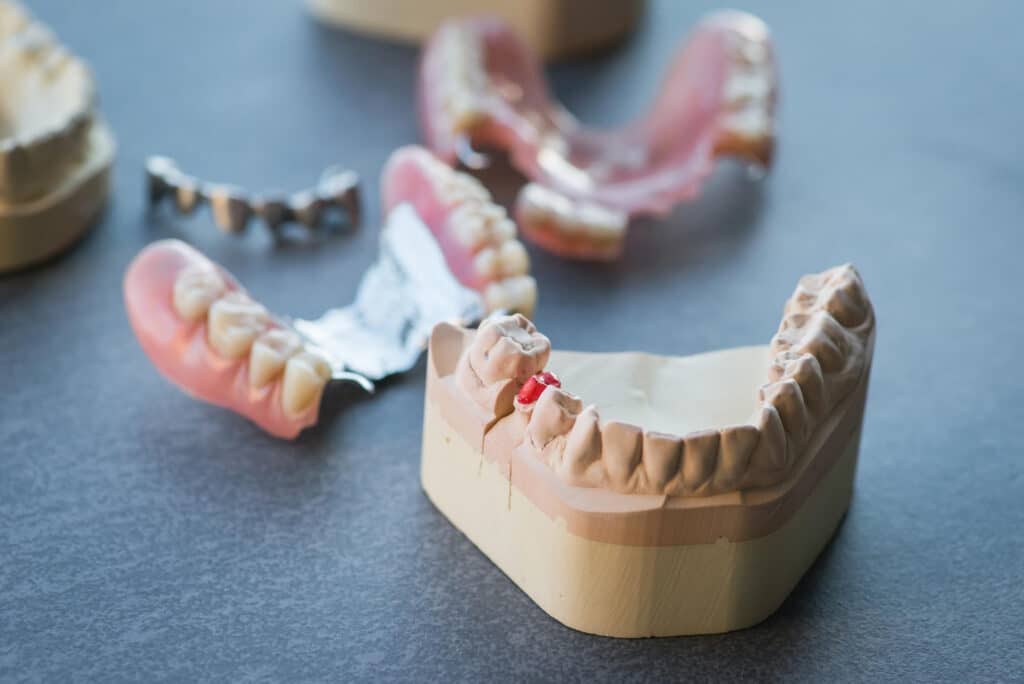 Materiales de prótesis dentales