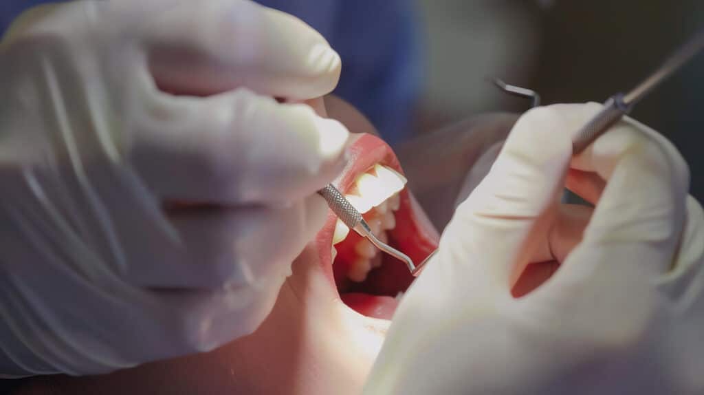 Implante dental