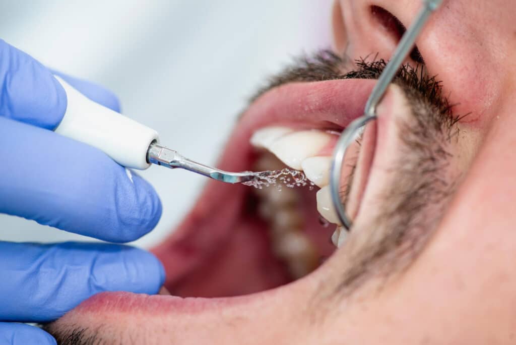 Revisión post endodoncia