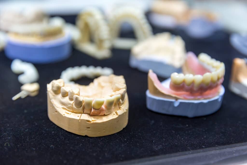 Elaboración de una prótesis dental
