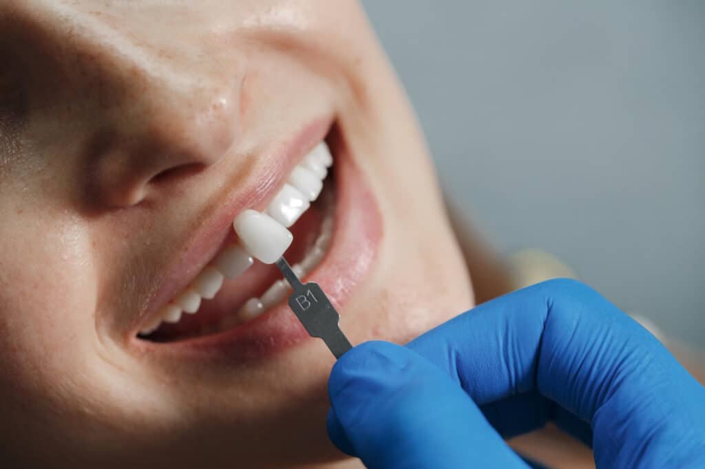 Dentista comprobando el tipo de implante