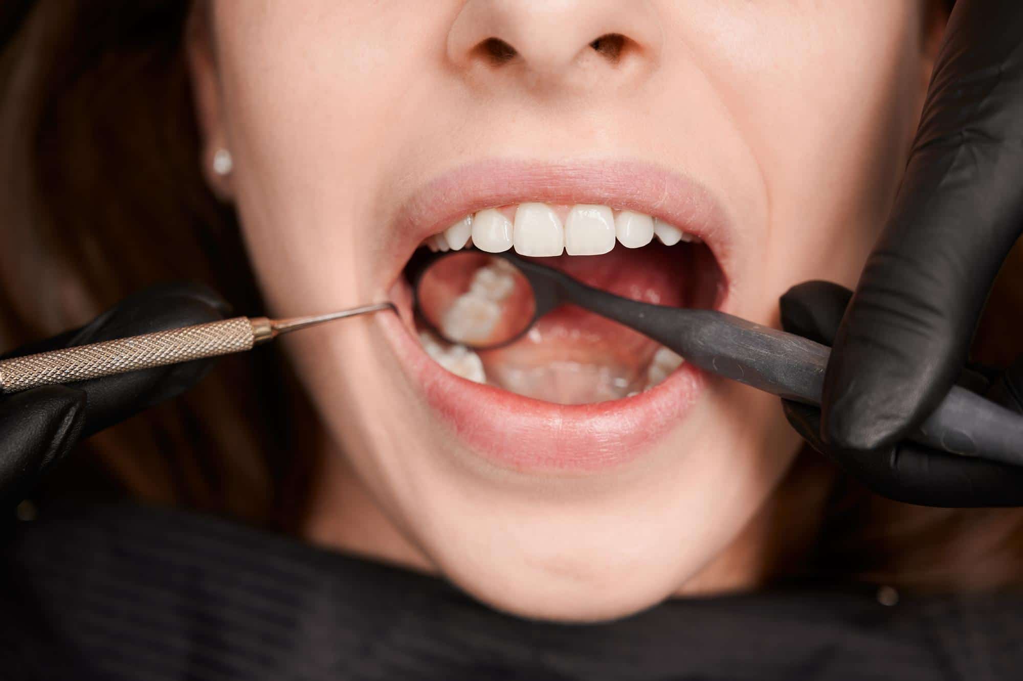 Periodoncia dental